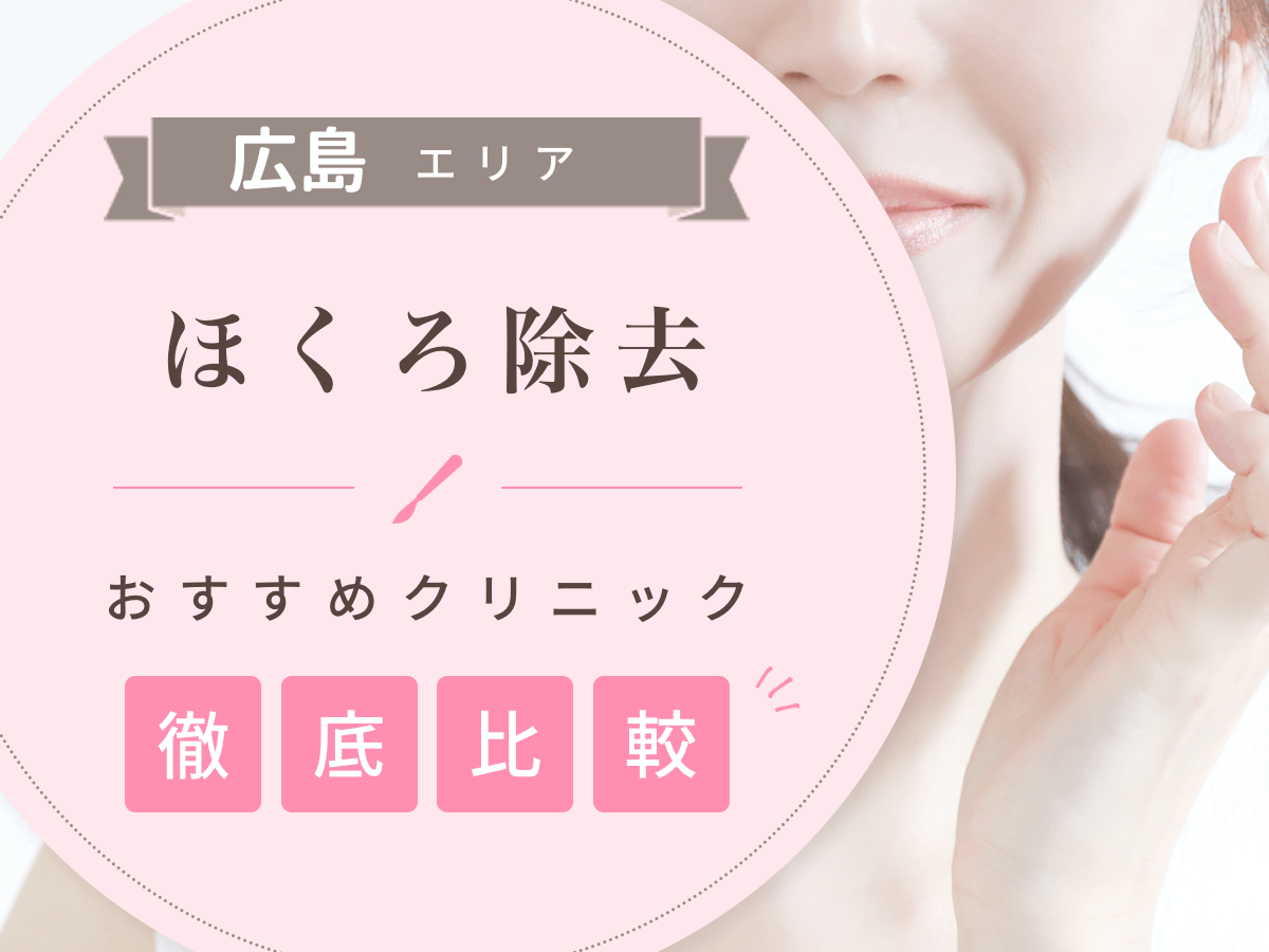 広島でほくろ除去がおすすめな値段の安いクリニックは？後悔しないために評判のいい病院を選ぶコツ